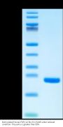 Biotinylated Human FGF1 Protein (FGF-HE40AB)