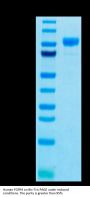 Human FGFR4 Protein (FGF-HM2R4)