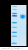 Biotinylated Human FGFR3 alpha (IIIc) Protein (FGF-HM43CB)