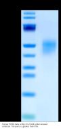 Human FGFR4 beta Protein (FGF-HM4RB)
