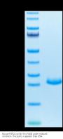 Mouse FGF21 Protein (FGF-MM121)