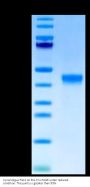 Non-biotinylated Cynomolgus FGL2 Protein (FGL-CM612)