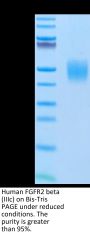 Human FGFR2 beta (IIIc) Protein (FGR-HM1BC)