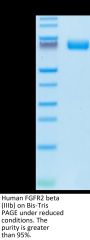 Human FGFR2 beta (IIIb) Protein (FGR-HM2BB)