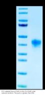 FITC-Labeled Human FOLR1 Protein (FOL-HM4R1F)