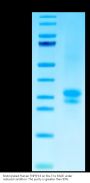 Biotinylated Human TNFSF15 Protein (Primary Amine Labeling) (FSF-HM115B)