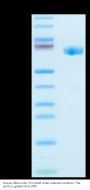 Human GBA/glucocerebrosidase Protein (GBA-HM101)