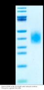 Human GCGR/Glucagon receptor Protein (GCR-HM40R)