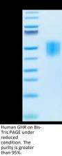 Human GHR/Growth Hormone R Protein (GHR-HM101)