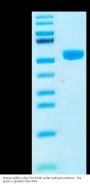 Human GIPR Protein (GIP-HM20R)