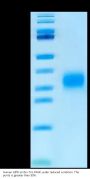 Human GIPR Protein (GIP-HM40R)