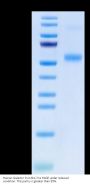 Human Galectin 9/LGALS9 Protein (GLT-HM109)