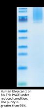 Human Glypican 1/GPC1 Protein (GPC-HM111)