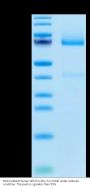 Biotinylated Human GPC3/Glypican 3 Protein (GPC-HM431B)