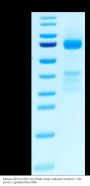Mouse GPC3/Glypican 3 Protein (GPC-MM131)