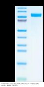 Human Her2/ErbB2 Protein, Ultra Low Endotoxin (HER-HM102-UL)