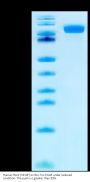 Human Her2/ErbB2 (S310F) Protein, Ultra Low Endotoxin (HER-HM112-UL)