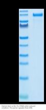 Human Her2/ErbB2 Protein, Ultra Low Endotoxin (HER-HM202-UL)