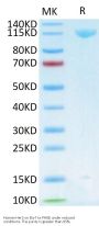 Human Her3/ErbB3 Protein (HER-HM203)