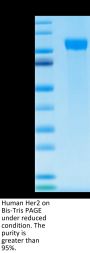 Human Her2/ErbB2 Protein (HER-HM402)