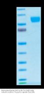 Biotinylated Human Her2/ErbB2 Protein (HER-HM402B)