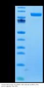 Human Her3/ErbB3 Protein (HER-HM403)