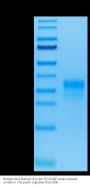 Human Her2/ErbB2 Domain 4 Protein (HER-HM404)