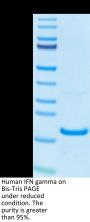 Human IFN gamma/IFNG Protein (IFN-HM00G)