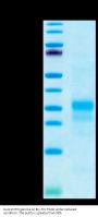 Human IFN gamma/IFNG Protein (IFN-HM40G)