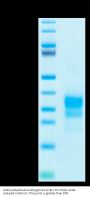 Biotinylated Human IFN gamma/IFNG Protein (IFN-HM40GB)