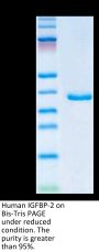 Human IGFBP-2 Protein (IGF-HM102)