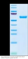 Human IGF2R Domain 1-3 Protein (IGF-HM1RD)