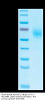 Biotinylated Human IL-1 Rrp2/IL-1 R6 Protein (IL1-HM4L2B)