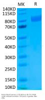 Biotinylated Human IL-17R alpha/CD217 Protein (IL1-HM5RAB)