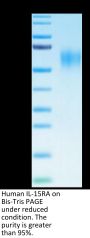 Human IL-15RA/IL-15 R alpha/CD215 Protein (IL5-HM4RA)
