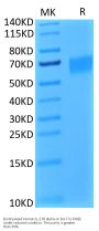 Biotinylated Human IL-17R alpha/CD217 Protein (ILR-HM417B)