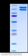 Cynomolgus Integrin alpha 2 beta 1 (ITGA2&ITGB1) Heterodimer Protein (ITG-CM1AB)