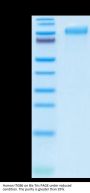 Human ITGB6 Protein (ITG-HM1B6)