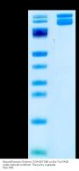 Mouse&Human Chimeric Integrin alpha V beta 6 (ITGAV&ITGB6) Heterodimer Protein (ITG-HM1V6)