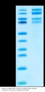 Human Integrin alpha 4 beta 7 (ITGA4&ITGB7) Heterodimer Protein (ITG-HM447)