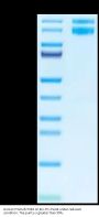 Human Integrin alpha V beta 1 (ITGAV&ITGB1) Heterodimer Protein (ITG-HM4V1)