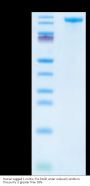 Human Jagged 1/JAG1 Protein (JAG-HM101)