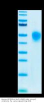 Human KIR2DL1 Protein (KIR-HM4L1)