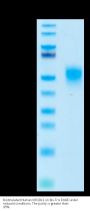 Biotinylated Human KIR2DL1 Protein (KIR-HM4L1B)
