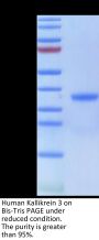Human Kallikrein 3/KLK3 Protein (KLK-HM103)