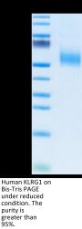 Human KLRG1 Protein (KLR-HM2G1)