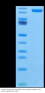 Human LDLR Protein (LDL-HM401)