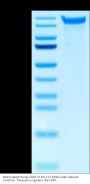 Biotinylated Human LDLR Protein (LDL-HM401B)
