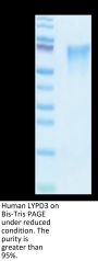 Human LYPD3 Protein (LPD-HM103)