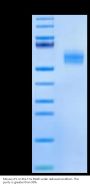 Mouse LTK Protein (LTK-MM101)